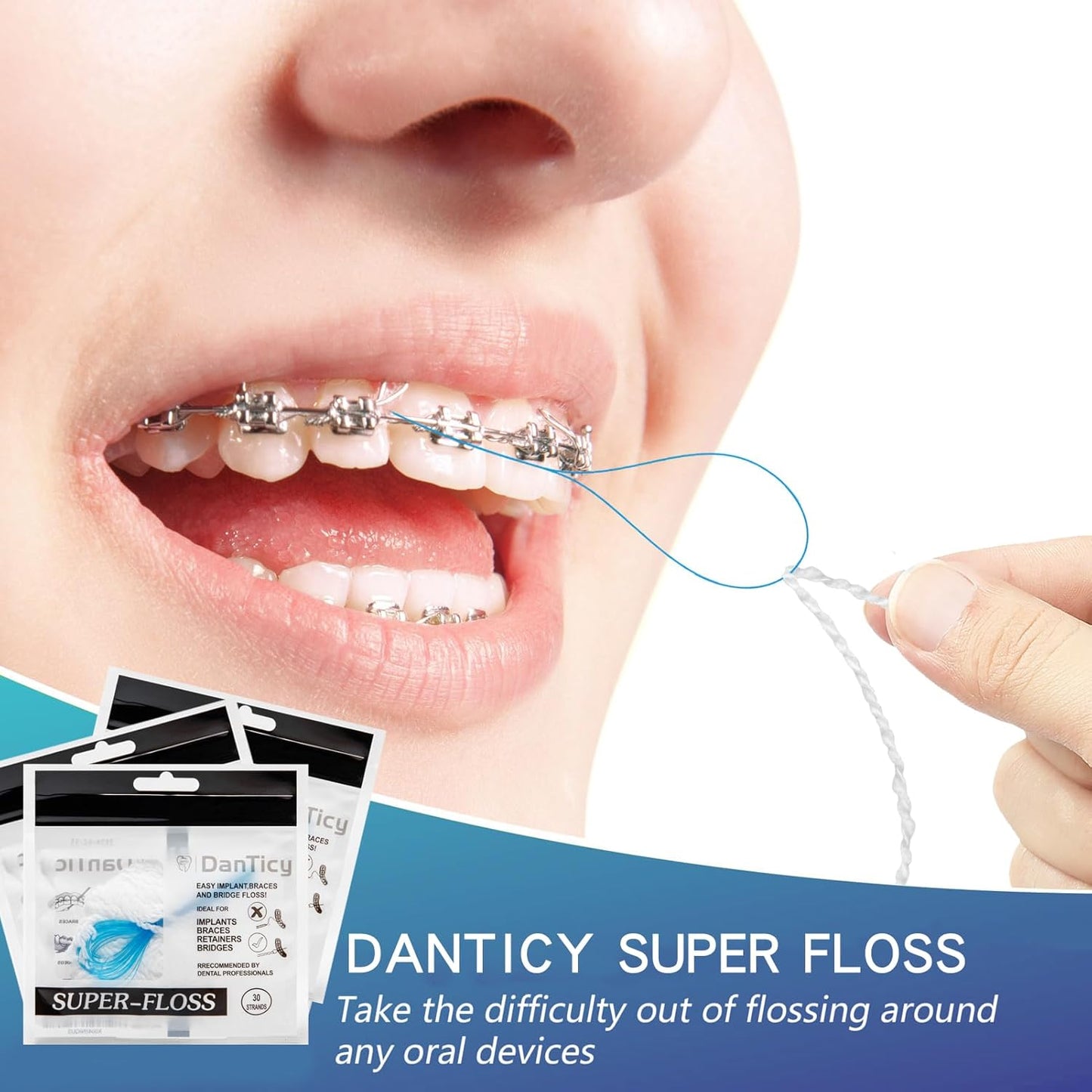 Super Floss Threaders, Periodontal Floss, Orthodontic Threader, Ultraclean Access Tool for Daily Care of Periodontal Disease and Gum Health for Implant, Bridge and Braces 30PCS