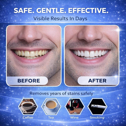 Professional Teeth Whitening Strips 21 Treatments – Pap+ Strips for Sensitive Teeth, Removes Coffee, Wine & Smoking Stains, Enamel Safe, Non-Slip, 42 Strips with Mouth Opener