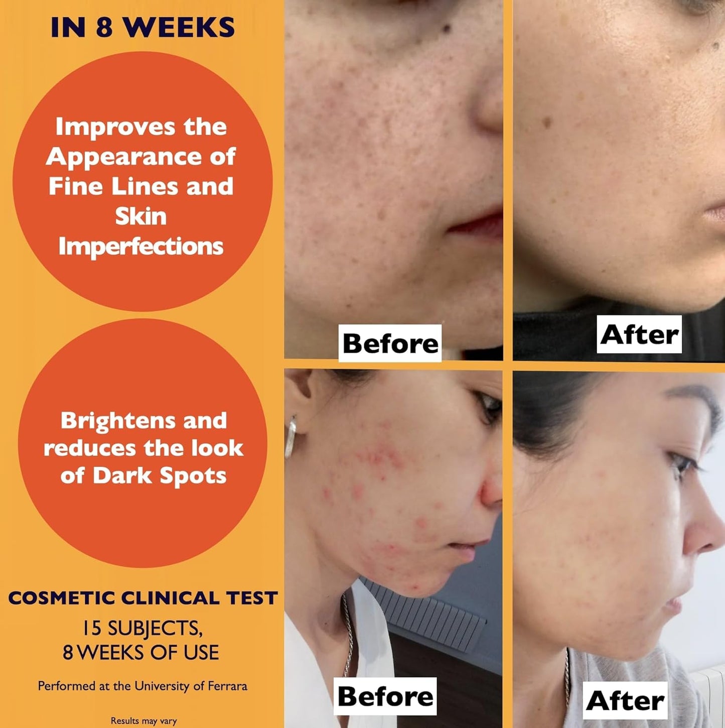 Big 2.11oz. Organic Vitamin C Serum for Face. Anti-Dark Spots, Wrinkles Skin Repair Serum with Hyaluronic Acid, Vitamin C & Niacinamide. All-in-One Brightening, Anti Aging Facial & Eye Area Skincare