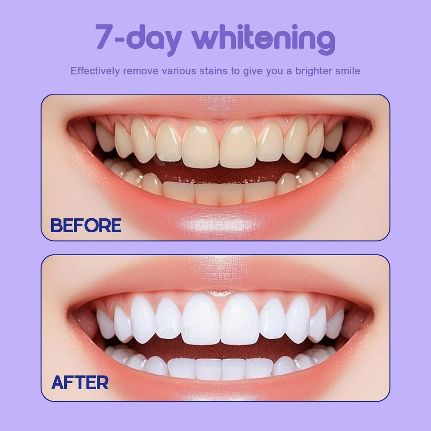Teeth Whitening Powder - Enamel-Safe & Sensitivity-Free, Natural Stain Remover for Coffee, Wine, Smoking & Tea, Gum Protection & Freshen Breath (50g (Pack of 1))