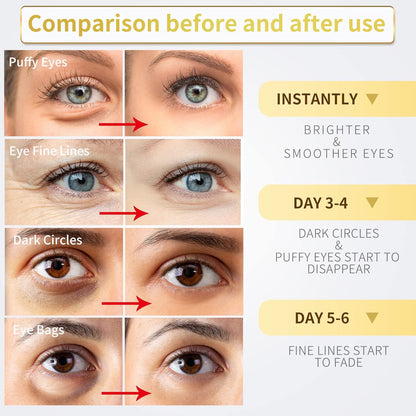 24K Gold Under Eye Patches - 60 Pack for Puffy Eyes, Dark Circles, Bags & Wrinkles with Collagen & Hyaluronic Acid - Eye Care Pads for Daily Skincare (Gold)